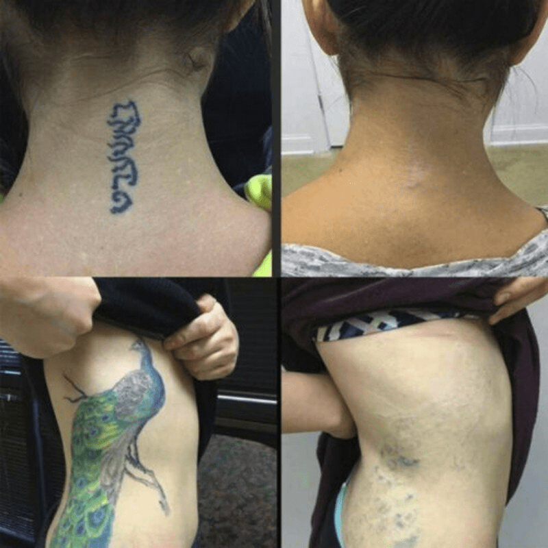 Tattoo Brightening Aftercare Balm Tattoo Care Cream Promote Skin Healing Tattoo  Brightening Treatment 15g | Shopee Philippines